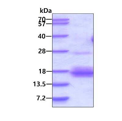 SDS-PAGE: Recombinant Human NXT1 His Protein [NBP1-72293]